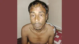 বিএসএফের গুলিতে আহত কৃষক হাসপাতাল থেকে লাপাত্তা