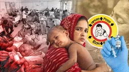 হাম ও উপসর্গে মৃত্যু হাজার ছাড়াল