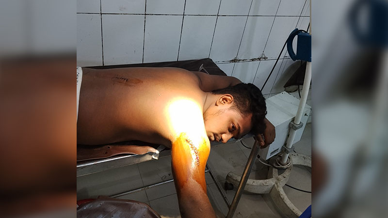 রাজধানীতে মুখ ঢেকে এসে ছাত্রশক্তি নেতাকে ছুরিকাঘাত