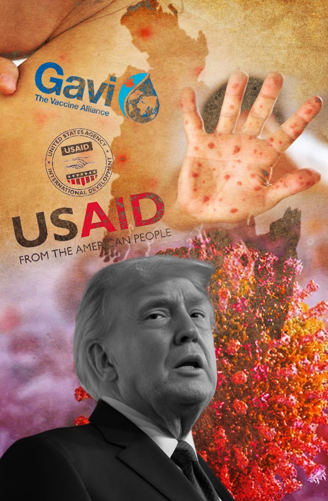 বাংলাদেশে হামের প্রাদুর্ভাব ও বৈশ্বিক স্বাস্থ্য সংকট: ট্রাম্প কি দায় এড়াতে পারেন?